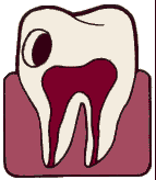 Gum Disease